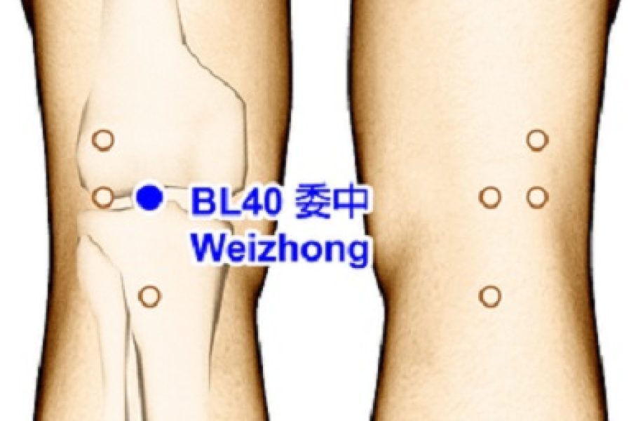 Aspen Bahove kapi i Bl 40